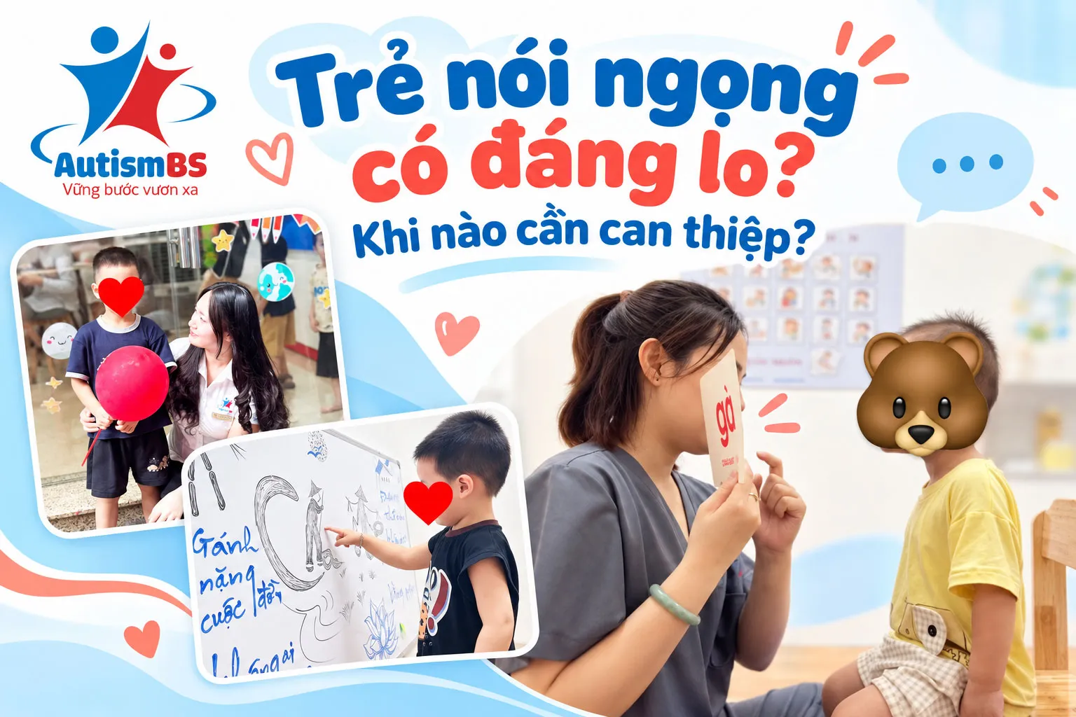 Trẻ nói ngọng có đáng lo? Khi nào cần can thiệp?